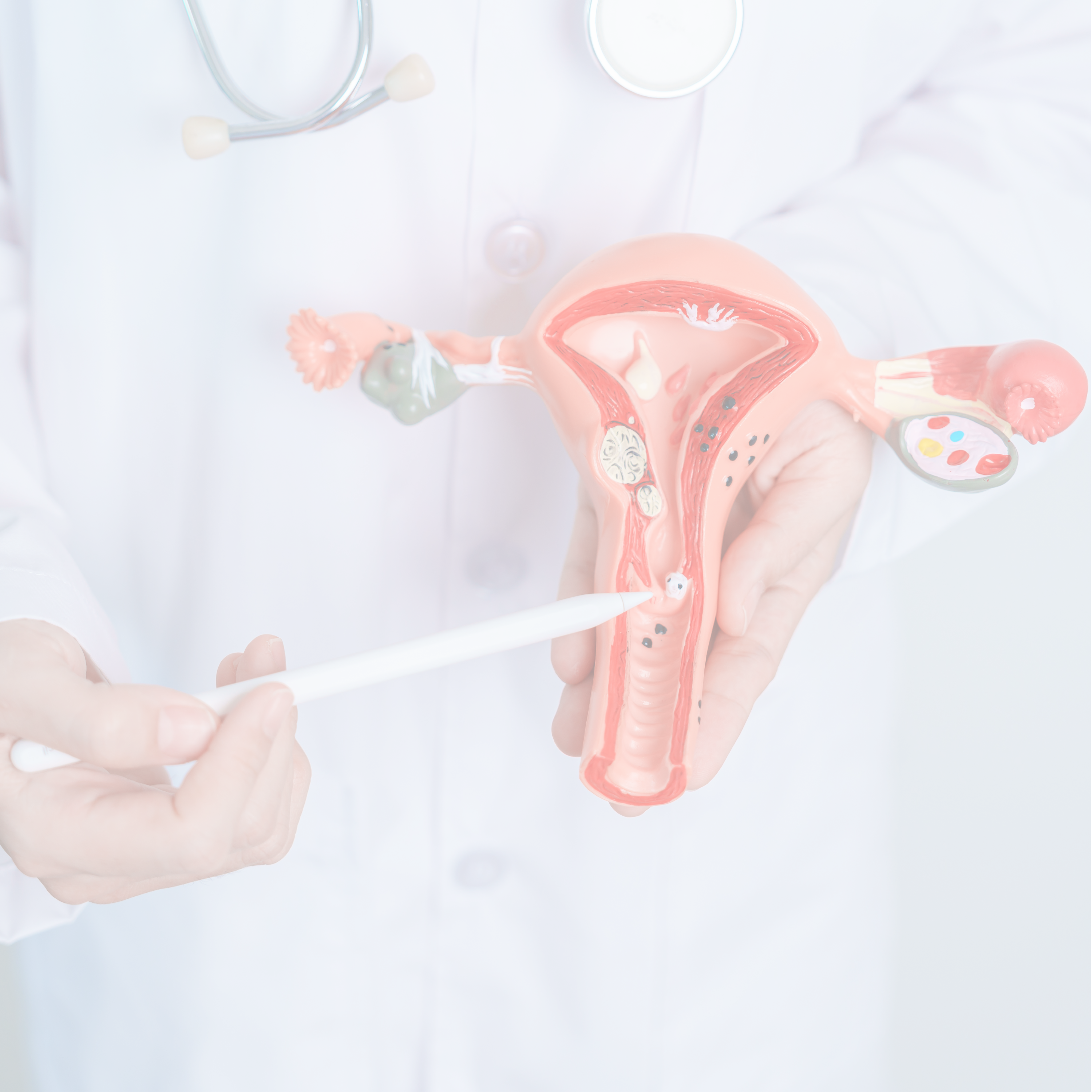 Médico explicando la situación de miomas en el útero